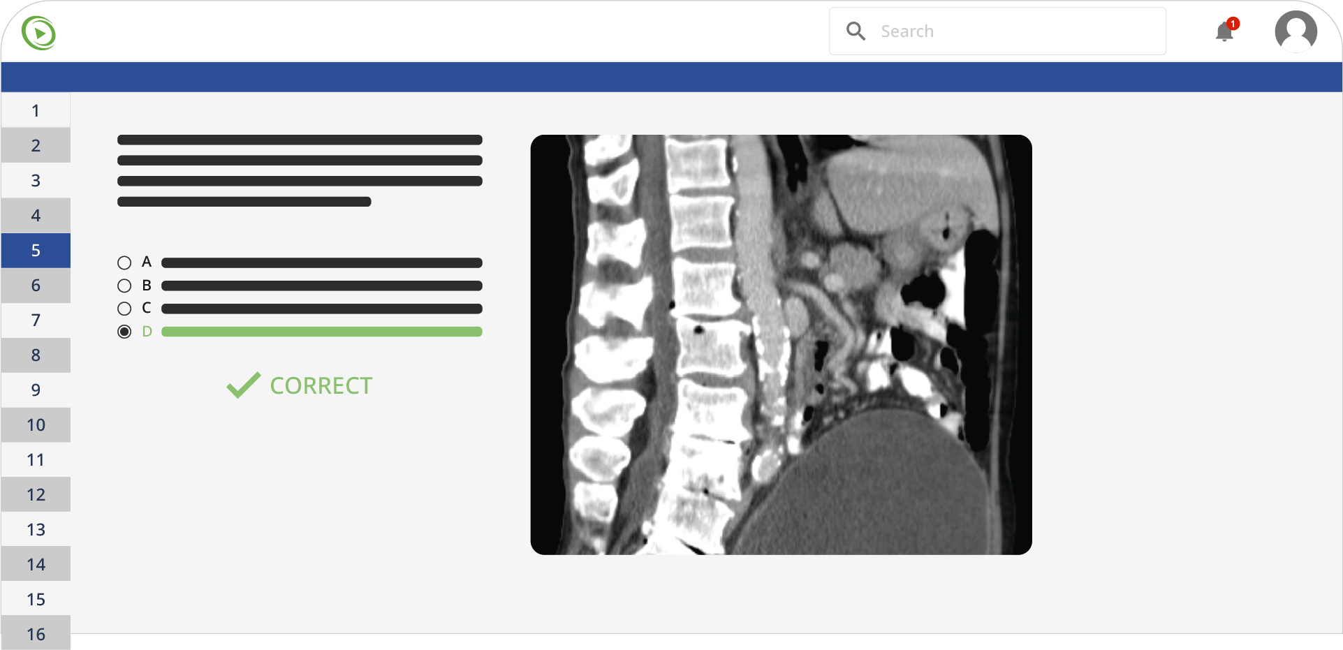 Sagittal spinal mri showing vertebrae, tissues, and pelvic region with correct option d marked.