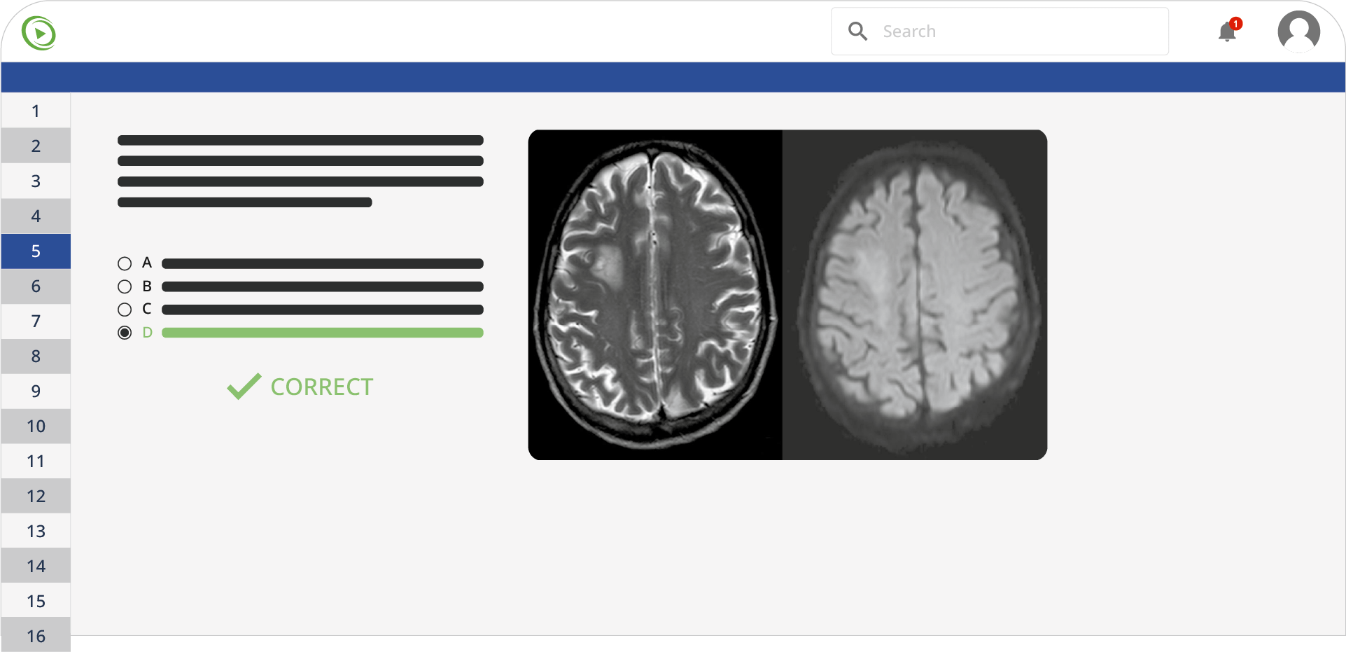 Medical imaging quiz screenshot with correct answer d marked.