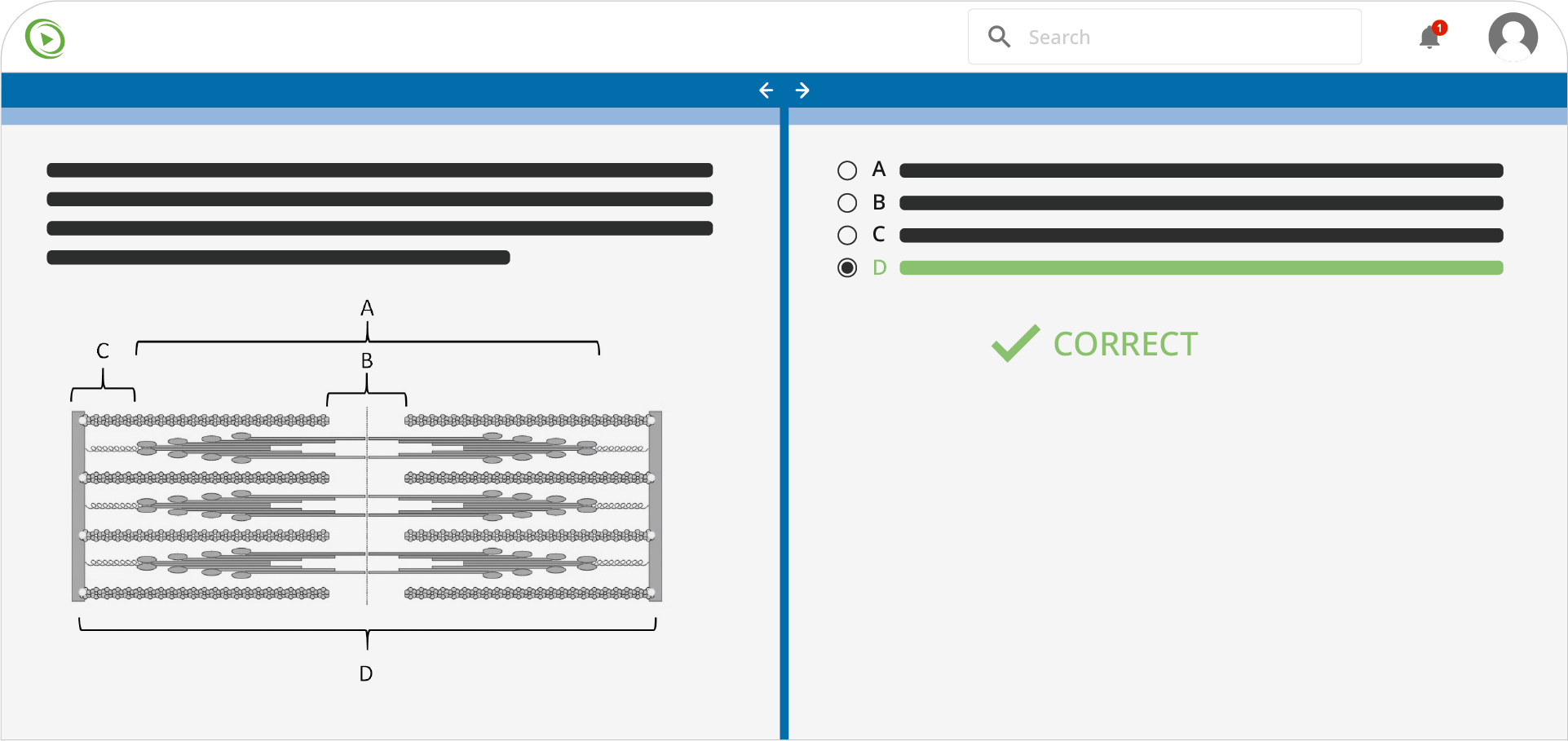 Usmle step 2 genetics quiz with labeled chromosome diagram and multiple choice answers.